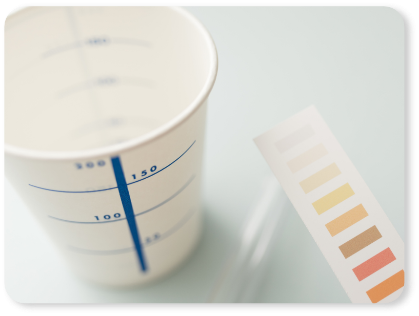 体重・血圧測定・尿検査