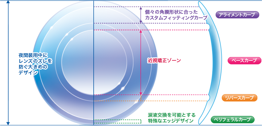 オルソケラトロジー用レンズについて