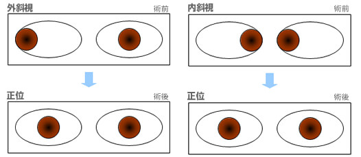 目のイラスト