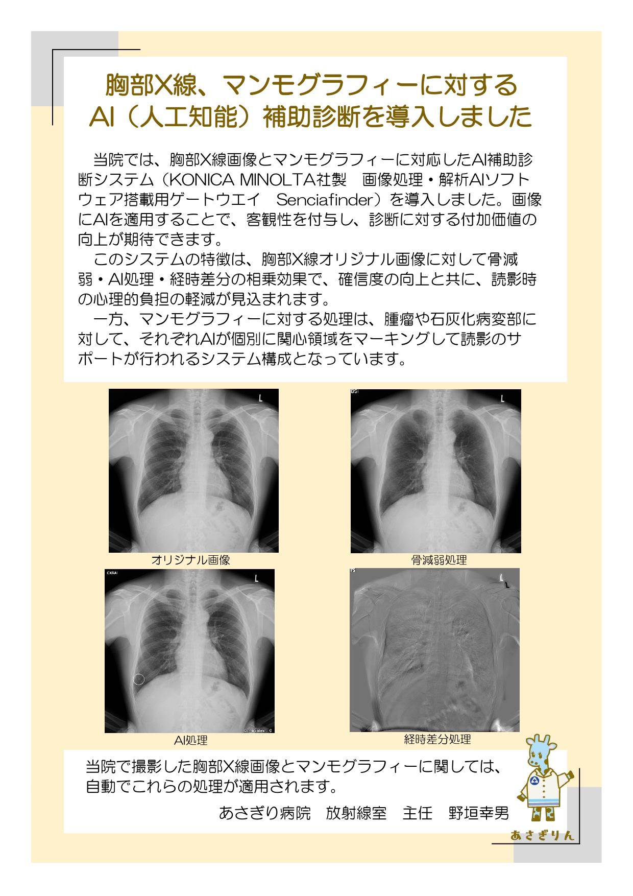 胸部X線、マンモグラフィーに対するAI（人工知能補助診断を導入しま
